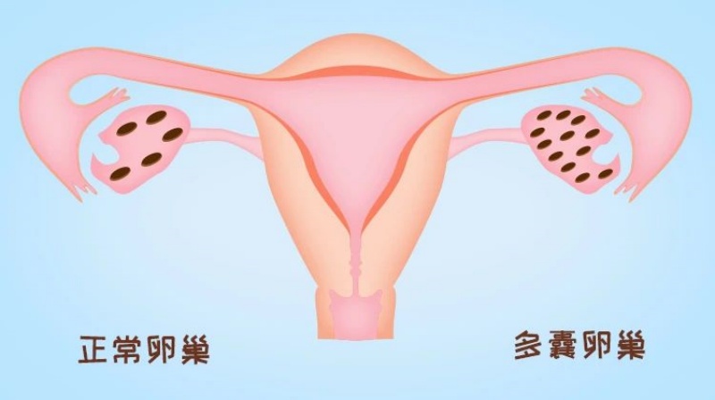 卵巢不好好排卵，到底是出了啥问题?快来一探究竟~