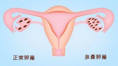 卵巢不好好排卵，到底是出了啥问题?快来一探究竟~