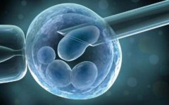 做试管压力大？教你几招轻松缓解，成功率都能翻倍~